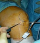 Αρθροσκόπηση Γόνατος
