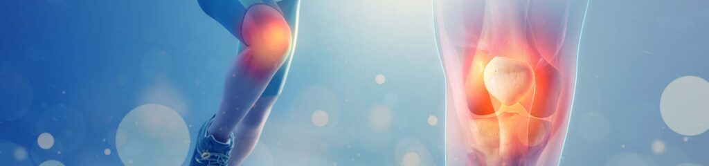 Το Πάσχον Γόνατο